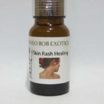 Skin Rash Healing Essential oil Blend – 10 ML